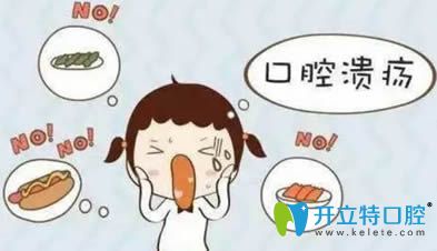 开立特网站口腔溃疡动画图 开立特网站口腔溃疡动画图