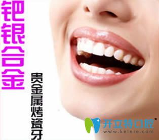 钯银烤瓷牙图 钯银烤瓷牙图