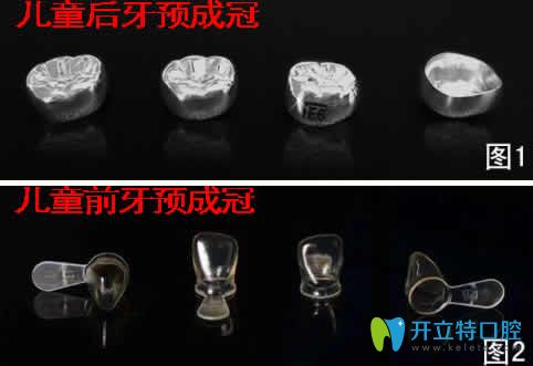儿童预成冠对牙齿有没有危害及戴预成冠后注意事项的详解
