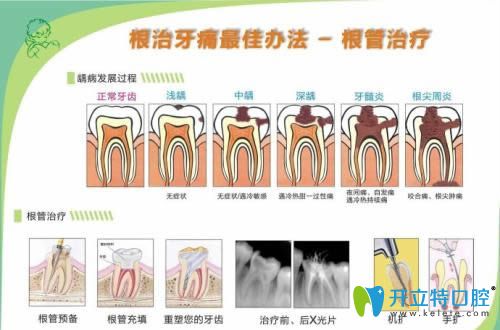 儿童乳牙优米app官方下载入口手机版步骤由厦门康德佳口腔进行科普