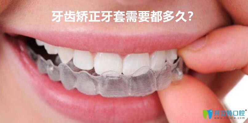 牙套要带多久？优米手机官网app选择传统的牙套好还是隐形的好？