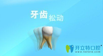 牙齿松了可以固定吗,那些问牙齿松了怎么拔的人怎么想的？
