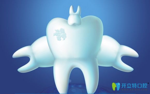 听说韩国登特斯种植牙价格便宜,那登特斯跟登腾哪个比较好?