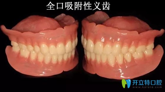 武汉仁爱口腔知识科普:吸附性义齿和普通义齿的区别及利弊