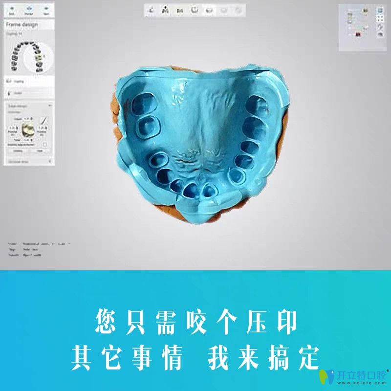 博世达隐形牙套具备其他品牌隐形牙套所不具备的优势