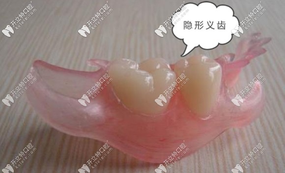 就想知道隐形义齿是否可以长期佩戴?包括晚上也不摘下来