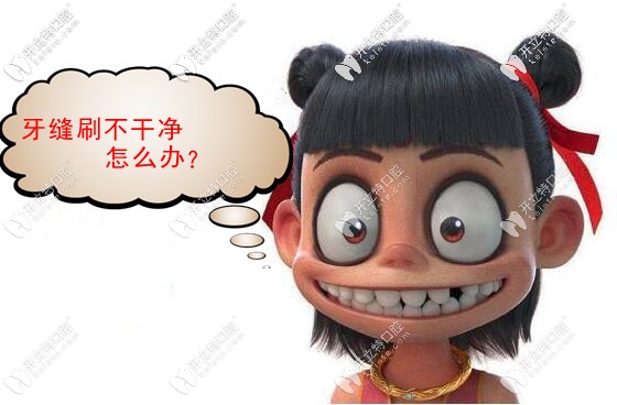 牙齿清洁神器：便携式冲牙器1分钟就把牙缝冲干净啦!