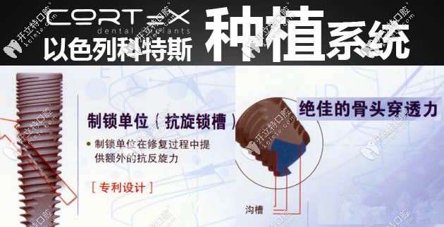 以色列cortex种植体优点 以色列cortex种植体优点