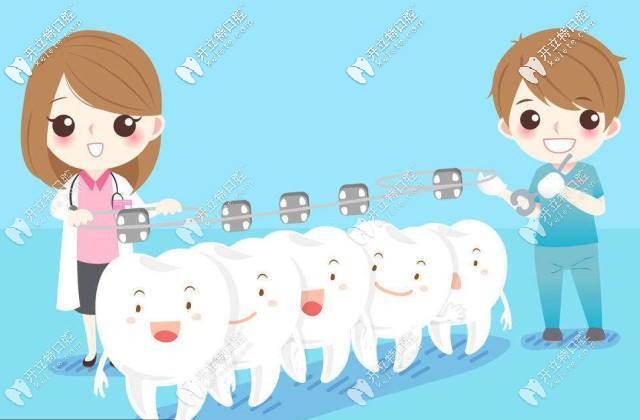Begg细丝弓固定矫正器 Begg细丝弓固定矫正器