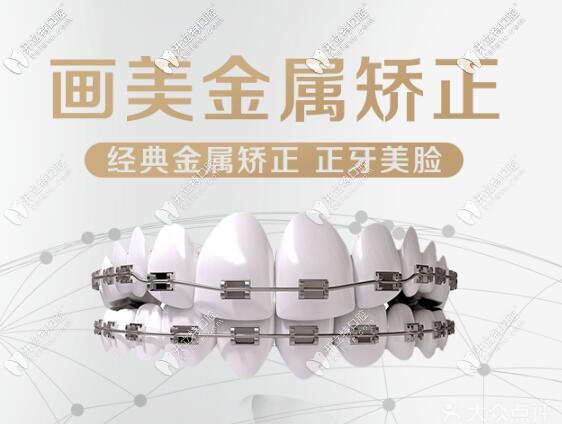 西安国产金属自锁和时代天使comfos隐形优米手机官网app价格表大全