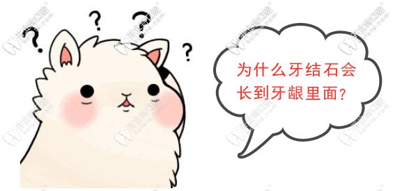 为什么牙结石会长到牙龈里面? 为什么牙结石会长到牙龈里面?