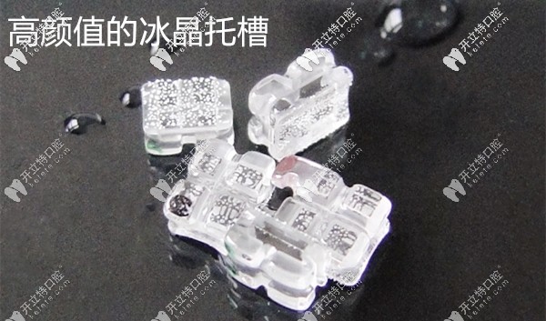 冰晶托槽半隐形矫正价格