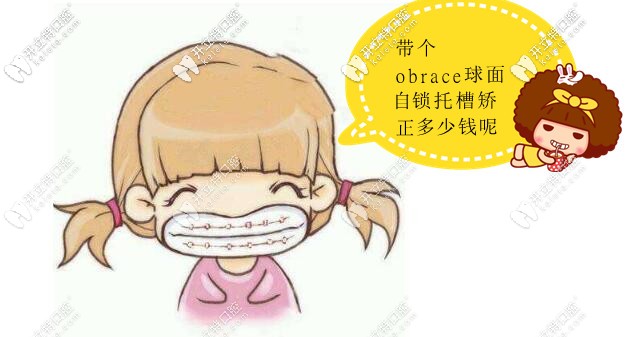 今日科普obrace球面自锁托槽多少钱,它和隐形比效果怎么样呢