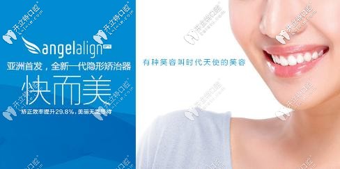天津美奥口腔做时代天使无托槽牙套费用来袭,收费不高哟